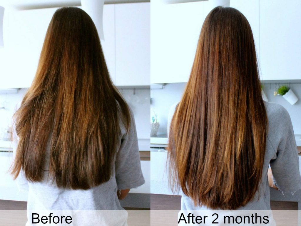 tóc mọc nhanh sau 2 tháng dùng dầu dừa